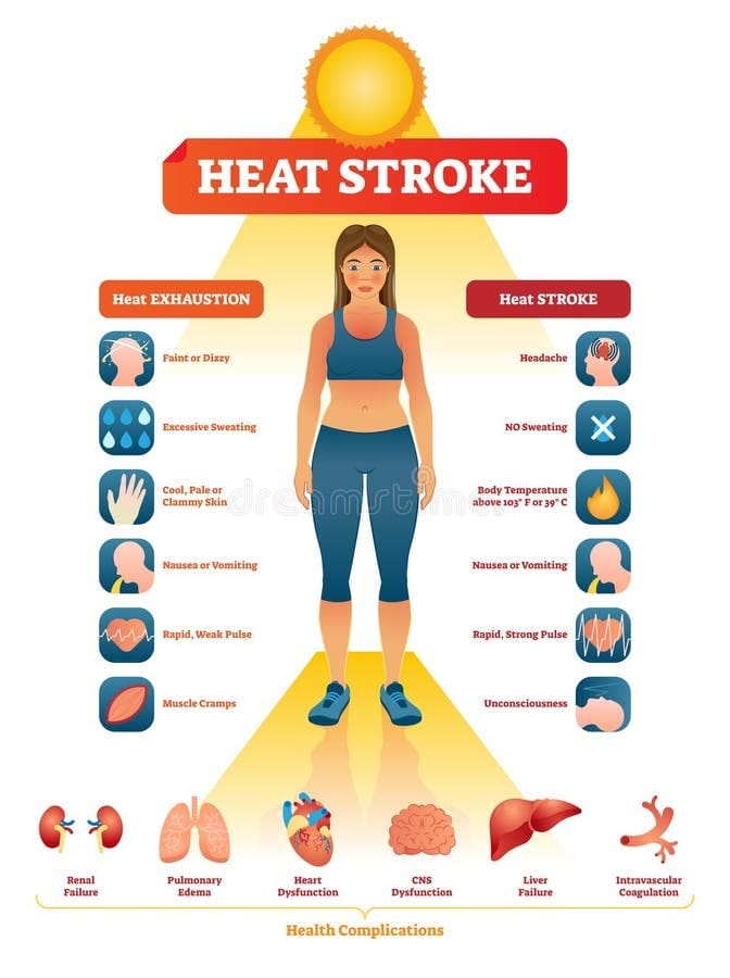 heat-stroke-illustration